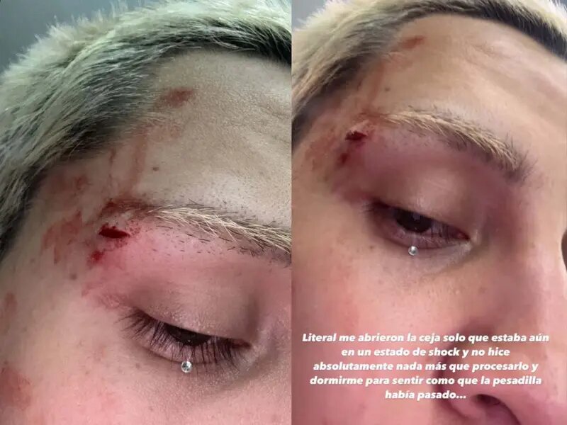 Kunno denuncia agresión homofóbica en Monterrey